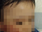 Anak 1 tahun penuh luka sepulang dari daycare di surabaya 1755224206195 169.jpeg