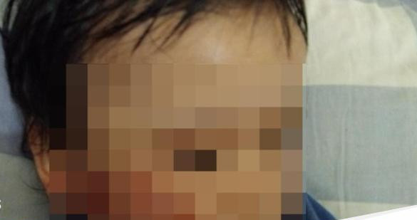 Anak 1 tahun penuh luka sepulang dari daycare di surabaya 1755224206195 169.jpeg