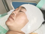 Warga malang harus operasi telinga gegara keseringan pakai cotton bud 1755139608302 169.jpeg