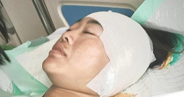 Warga malang harus operasi telinga gegara keseringan pakai cotton bud 1755139608302 169.jpeg